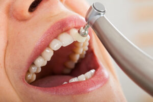 Professional Teeth Cleaning: The Reset Your Smile Needs More Than You Think